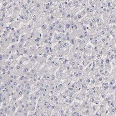 Immunohistochemistry-Paraffin: G Protein alpha z Antibody [NBP1-88111] - Staining of human liver shows no positivity in hepatocytes as expected.