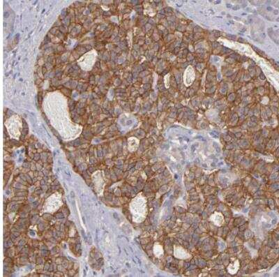 Immunohistochemistry-Paraffin: G Protein alpha z Antibody [NBP1-88111] - Staining of human pancreas shows strong membranous positivity in islets of langerhans.