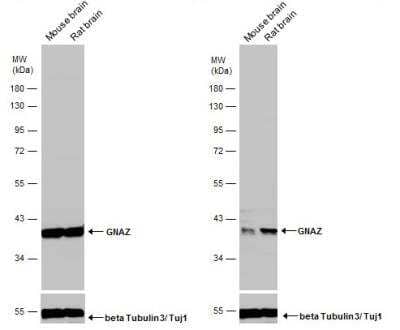 <b>Independent Antibodies Validation. </b>Western Blot: G Protein alpha z Antibody [NBP1-31604] - Various tissue extracts (50 ug) were separated by 10% SDS-PAGE, and the membranes were blotted with GNAZ antibody [N2C3].
