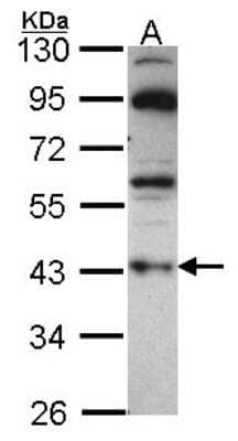 <b>Independent Antibodies Validation. </b>Western Blot: G Protein alpha z Antibody [NBP2-16561] - Sample (30 ug of whole cell lysate) A: A549 10% SDS PAGE gel, diluted at 1:1000.