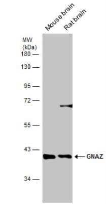 Western Blot: G Protein alpha z Antibody [NBP2-16561] - Various tissue extracts (50 ug) were separated by 10% SDS-PAGE, and the membrane was blotted with G protien alpha z antibody diluted at 1:5000.