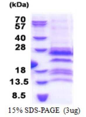 SDS-Page: G antigen 12F Protein [NBP2-23065]