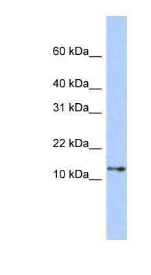 Western Blot: G gamma14 Antibody [NBP1-56676] - 293T cells lysate, concentration 0.2-1 ug/ml.