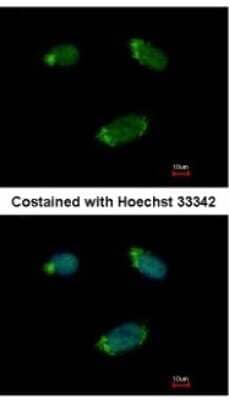 Immunocytochemistry/Immunofluorescence: G protein alpha 16 Antibody [NBP2-16557] - Analysis of paraformaldehyde-fixed HeLa, using antibody at 1:500 dilution.