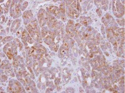 Immunohistochemistry-Paraffin: G protein alpha 16 Antibody [NBP2-16557] -  CX-1 xenograft. G protein alpha 16 antibody dilution: 1:500. Antigen Retrieval: Trilogy™ (EDTA based, pH 8.0) buffer, 15min.