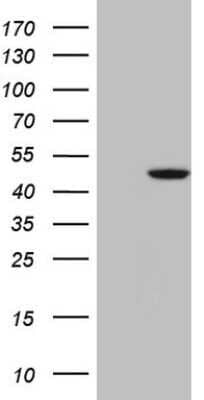 Western Blot: G protein alpha 16 Antibody (OTI6B3) - Azide and BSA Free [NBP2-70836] - Analysis of HEK293T cells were transfected with the pCMV6-ENTRY control (Left lane) or pCMV6-ENTRY G protein alpha 16.