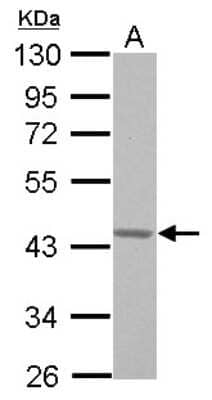 Western Blot: G protein alpha 16 Antibody [NBP2-16557] - 30 ug THP-1 whole cell lysate/extract 10% SDS-PAGE G protein alpha 16 antibody dilution: 1:1000.