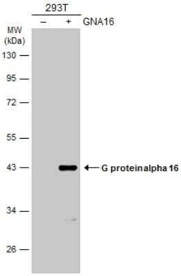 Western Blot: G protein alpha 16 Antibody [NBP2-16557] - Non-transfected (-) and transfected (+) 293T whole cell extracts (30 ug) were separated by 10% SDS-PAGE, and the membrane was blotted with G protein alpha 16 antibody diluted at 1:1000. The HRP-conjugated anti-rabbit IgG antibody (NBP2-19301) was used to detect the primary antibody.