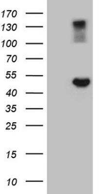 Western Blot: G protein alpha Antibody (OTI12D9) [NBP2-45899] - HEK293T cells were transfected with the pCMV6-ENTRY control (Left lane) or pCMV6-ENTRY GNAS (Right lane) cDNA for 48 hrs and lysed. Equivalent amounts of cell lysates (5 ug per lane) were separated by SDS-PAGE and immunoblotted with anti-GNAS.