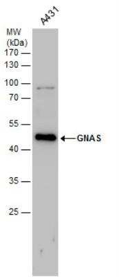 Western Blot: G protein alpha Antibody [NBP1-31405] - Whole cell extracts (30 ug) was separated by 12% SDS-PAGE, and the membrane was blotted with GNAS antibody diluted by 1:500.