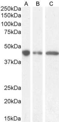 Western Blot: G protein alpha Antibody [NBP1-49874] - (0.5ug/ml) staining of Human Cerebellum (A) and (0.1ug/ml) Mouse (B) and Rat (C) Brain lysate (35ug protein in RIPA buffer). Detected by chemiluminescence.