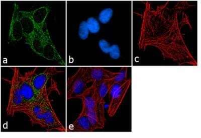 Immunofluorescence: G protein alpha inhibitor 1/2 Antibody [NB120-3522] - Analysis of G Protein alpha Inhibitor 1 and 2 was performed using 70% confluent log phase SH-SY5Y cells.