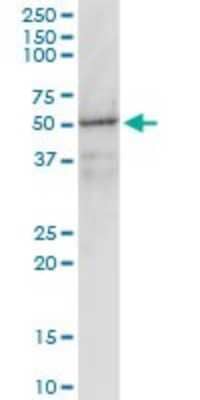 Western Blot: G protein alpha inhibitor 1 Antibody (2B8-2A5) [H00002770-M01] - GNAI1 monoclonal antibody (M01), clone 2B8-2A5. Analysis of GNAI1 expression in human liver.