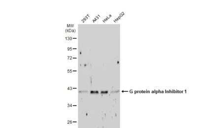 Western Blot: G protein alpha inhibitor 1 Antibody [NBP1-31601] - Various whole cell extracts (30 ug) were separated by 10% SDS-PAGE, and the membrane was blotted with G protein alpha Inhibitor 1 antibody diluted at 1:500. The HRP-conjugated anti-rabbit IgG antibody (NBP2-19301) was used to detect the primary antibody. 