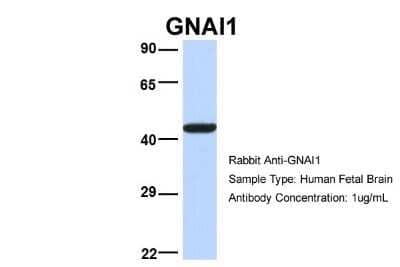 Western Blot: G protein alpha inhibitor 1 Antibody [NBP1-52926] - Human Fetal Brain, Antibody Dilution: 1.0 ug/ml.