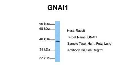 Western Blot: G protein alpha inhibitor 1 Antibody [NBP1-52926] - Sample Tissue: Human Fetal Lung Antibody Dilution: 1.0 ug/ml