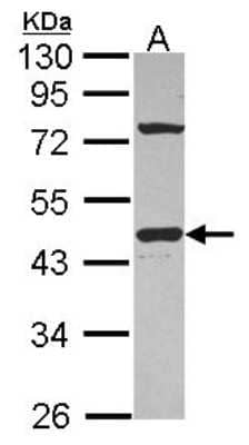 Western Blot: G protein alpha inhibitor 1 Antibody [NBP2-16558] - Sample (30 ug of whole cell lysate) A: JurKat 10% SDS PAGE gel, diluted at 1:1000.