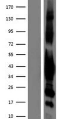 Western Blot: G protein alpha inhibitor 1 Overexpression Lysate (Adult Normal) [NBP2-10798] Left-Empty vector transfected control cell lysate (HEK293 cell lysate); Right -Over-expression Lysate for G protein alpha inhibitor 1.