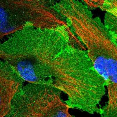 Immunocytochemistry/Immunofluorescence: G protein beta 4 Antibody [NBP2-14060] - Staining of human cell line U-2 OS shows localization to plasma membrane. Antibody staining is shown in green.