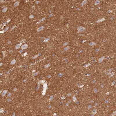 Immunohistochemistry-Paraffin: G protein beta 4 Antibody [NBP2-14060] - Staining of human cerebral cortex shows strong positivity in neuropil.