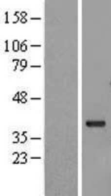 Western Blot: G protein beta subunit like Overexpression Lysate (Adult Normal) [NBL1-10995] Left-Empty vector transfected control cell lysate (HEK293 cell lysate); Right -Over-expression Lysate for G protein beta subunit like.