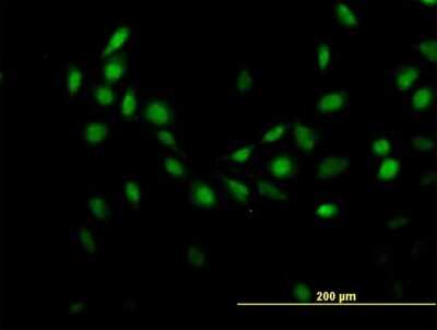 Immunocytochemistry/Immunofluorescence: G-substrate Antibody [H00010842-B01P] - Analysis of purified antibody to C7orf16 on HeLa cell. (antibody concentration 10 ug/ml)