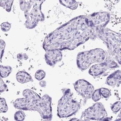 Immunohistochemistry-Paraffin: G-substrate Antibody [NBP2-13800] - Staining of human placenta shows no positivity in trophoblastic cells as expected.