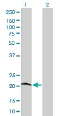 Western Blot: G-substrate Antibody [H00010842-D01P] - Analysis of C7orf16 expression in transfected 293T cell line by C7orf16 polyclonal antibody.Lane 1: C7orf16 transfected lysate(17.90 KDa).Lane 2: Non-transfected lysate.