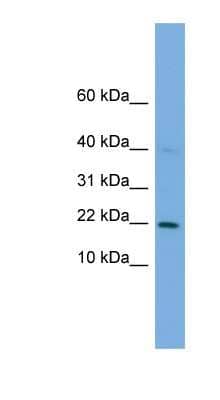 Western Blot: G-substrate Antibody [NBP1-79480] - THP-1 cell lysate, concentration 0.2-1 ug/ml.