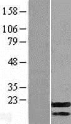 Western Blot: G-substrate Overexpression Lysate (Adult Normal) [NBL1-08543] Left-Empty vector transfected control cell lysate (HEK293 cell lysate); Right -Over-expression Lysate for G-substrate.