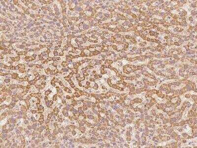 Immunohistochemistry-Paraffin: G0S2 Antibody [NBP3-06188] - Immunochemical staining of human G0S2 in human liver with rabbit polyclonal antibody at 1:100 dilution, formalin-fixed paraffin embedded sections.