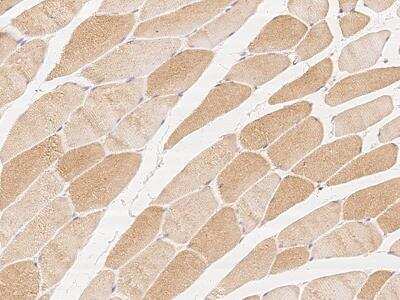 Immunohistochemistry-Paraffin: G0S2 Antibody [NBP3-06188] - Immunochemical staining of human G0S2 in human skeletal muscle with rabbit polyclonal antibody at 1:100 dilution, formalin-fixed paraffin embedded sections.