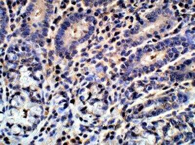 Immunohistochemistry-Paraffin: G0S2 Antibody [NBP3-12396] - Mouse small intestine. 1:50 dilution in IHC blocking buffer. DAB (brown) staining and Hematoxylin QS (blue) counterstain. 40X magnification.