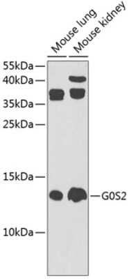 Western Blot: G0S2 Antibody [NBP3-03898] - Analysis of extracts of various cell lines, using G0S2 antibody at 1:1000 dilution. Secondary antibody: HRP Goat Anti-Rabbit IgG (H+L) at 1:10000 dilution. Lysates/proteins: 25ug per lane. Blocking buffer: 3% nonfat dry milk in TBST. Detection: ECL Enhanced Kit