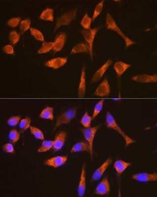 Immunocytochemistry/Immunofluorescence: G3BP1 Antibody (5A4T0) [NBP3-16302] - Immunofluorescence analysis of HeLa cells using G3BP11 Rabbit mAb (NBP3-16302) at dilution of 1:100 (40x lens). Blue: DAPI for nuclear staining.