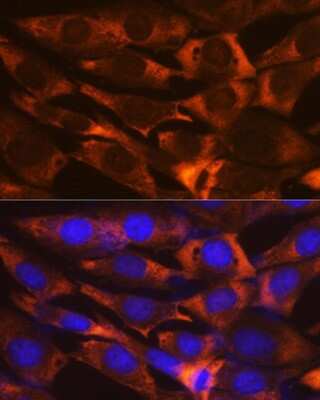 Immunocytochemistry/Immunofluorescence: G3BP1 Antibody (5A4T0) [NBP3-16302] - Immunofluorescence analysis of NIH-3T3 cells using G3BP11 Rabbit mAb (NBP3-16302) at dilution of 1:100 (40x lens). Blue: DAPI for nuclear staining.