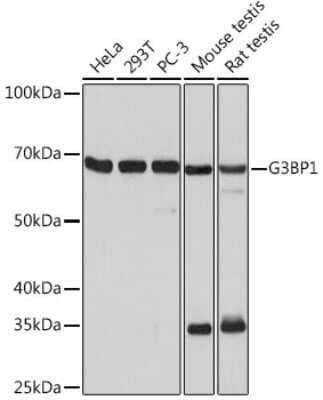 Western Blot: G3BP1 Antibody (5A4T0) [NBP3-16302] - Western blot analysis of extracts of various cell lines, using G3BP11 Rabbit mAb (NBP3-16302) at 1:1000 dilution. Secondary antibody: HRP Goat Anti-Rabbit IgG (H+L) at 1:10000 dilution. Lysates/proteins: 25ug per lane. Blocking buffer: 3% nonfat dry milk in TBST. Detection: ECL Basic Kit. Exposure time: 10s.