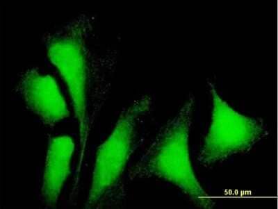 Immunocytochemistry/Immunofluorescence: G3BP1 Antibody [H00010146-B01P] - Analysis of purified antibody to G3BP1 on HeLa cell. (antibody concentration 10 ug/ml)