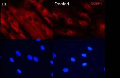 Immunocytochemistry/Immunofluorescence: G3BP1 Antibody [NBP1-18922] - G3BP1 in red (Alexa fluor 555) and nucleus in blue (DAPI). Human primary fibroblasts untreated in the left and treated in the right with G3BP1 stress granules labeling. Alexa fluor 555 1s exposure and DAPI 1s exposure. Fixation: PFA 4% 10min RT,  permeabilization: Triton 0.1% TBS, blocking: Donkey Serum 10% TBS-T, Ab dilution: 1:1000, Secondary Ab: Alexa fluor 555 Donkey anti-rabbit 1:600, Mounting medium with DAPI. Image submitted by a verified customer review. 