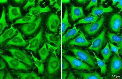 Immunocytochemistry/Immunofluorescence: G3BP1 Antibody [NBP2-16563] - HeLa cells were fixed in 4% paraformaldehyde at RT for 15 min. Green: G3BP1 stained by G3BP1 antibody  diluted at 1:2000. Blue: Fluoroshield with DAPI.  Scale bar= 10 um. 