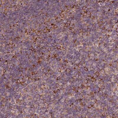 Immunohistochemistry-Paraffin: G3BP1 Antibody [NBP1-83404] - Staining of human lymph node shows positivity in lymphoid cells.