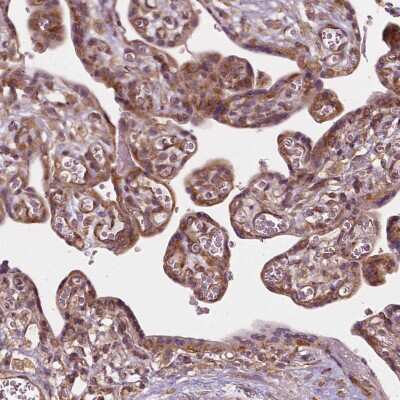 Immunohistochemistry-Paraffin: G3BP1 Antibody [NBP1-83404] - Staining of human placenta shows positivity in trophoblastic cells.