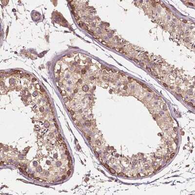 Immunohistochemistry-Paraffin: G3BP1 Antibody [NBP1-83404] - Staining of human testis shows positivity in cells in seminiferous ducts.