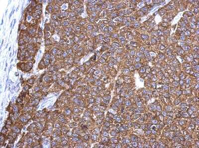 Immunohistochemistry-Paraffin: G3BP1 Antibody [NBP2-16563] -  Hela xenograft, using G3BP1 antibody at 1:500 dilution. Antigen Retrieval: Trilogy™ (EDTA based, pH 8.0) buffer, 15min