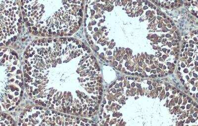 Immunohistochemistry-Paraffin: G3BP1 Antibody [NBP2-16563] -  Mouse testis. G3BP1 stained by G3BP1 antibody diluted at 1:500. Antigen Retrieval: Citrate buffer, pH 6.0, 15 min. 