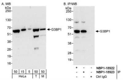 <b>Independent Antibodies Validation and Biological Strategies Validation.</b>Western Blot: G3BP1 Antibody [NBP1-18922] - Whole cell lysate from HeLa (5, 15 and 50 mcg for WB; 1 mg for IP, 20% of IP loaded), 293T (T; 50 mcg) and mouse NIH3T3 (M; 50mcg) cells.  Affinity purified rabbit anti-G3BP1 antibody  used for WB at 0.04 mcg/ml (A) and 1 mcg/ml (B) and used for IP at 3 mcg/mg lysate. G3BP1 was also immunoprecipitated by rabbit anti-G3BP1 antibody NBP1-18923, which recognizes a downstream epitope.