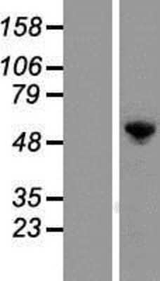 Western Blot: G3BP1 Overexpression Lysate (Adult Normal) [NBP2-04730] Left-Empty vector transfected control cell lysate (HEK293 cell lysate); Right -Over-expression Lysate for G3BP1.