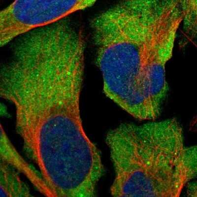 Immunocytochemistry/Immunofluorescence: G3BP2 Antibody [NBP1-82977] - Immunofluorescent staining of human cell line U-2 OS shows localization to cytosol.