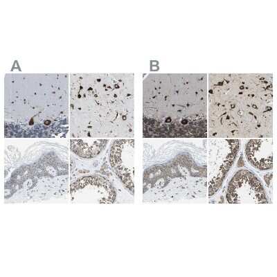 <b>Independent Antibodies Validation and Orthogonal Strategies Validation.</b>Immunohistochemistry-Paraffin: G3BP2 Antibody [NBP1-82976] - Staining of human cerebellum, cerebral cortex, skin and testis using Anti-G3BP2 antibody NBP1-82976 (A) shows similar protein distribution across tissues to independent antibody NBP1-82977 (B).