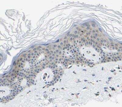 Immunohistochemistry-Paraffin: G3BP2 Antibody [NBP1-82976] - Staining of human skin shows very weak cytoplasmic positivity in epidermal cells.